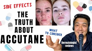 ACCUTANE  Dermatologist Review Unbiased [upl. by Nnylyrehc242]