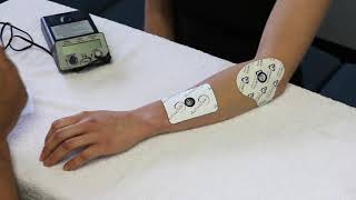 How to set up Iontophoresis [upl. by Adnarim]