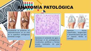 ¿Cómo combatir la ARTROSIS Consejos y recomendaciones de un fisioterapeuta [upl. by Cooperman71]