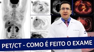 PET Scan ou PETCT  Como é feito o exame  IMEB [upl. by Andree]