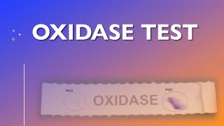 Oxidase Test [upl. by Durarte398]