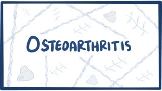 Osteoarthritis vs rheumatoid arthritis symptoms  NCLEXRN  Khan Academy [upl. by Nalra]