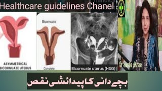 BICORNUATE UTERUS [upl. by Soisinoid70]