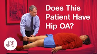 Does This Patient Have Hip Osteoarthritis [upl. by Phail]