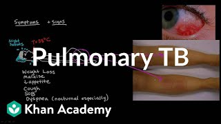 Pulmonary TB  Infectious diseases  NCLEXRN  Khan Academy [upl. by Doggett306]