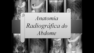 Anatomia Radiográfica do Abdome [upl. by Zoubek]