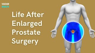 Life After Enlarged Prostate Surgery [upl. by Ettezus9]