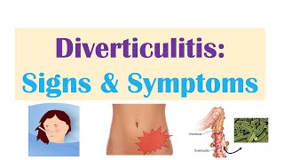 Diverticulitis Risk Factors ex Low Fiber Diets Symptoms Diagnosis Treatment and Complications [upl. by Caralie]