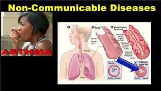 Noncommunicable Diseases [upl. by Llednahc]