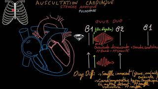 Auscultation cardiaque  Souffles cardiaquesbruits surajoutésExercices  Partie 2 Docteur Synapse [upl. by Tarr]