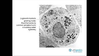 Ask the Expert  Part 3 How does Legionella grow [upl. by Melak28]