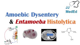 Amebiasis Amoebic Dysentery  Entamoeba histolytica Pathogenesis Signs amp Symptoms Treatment [upl. by Noonan882]