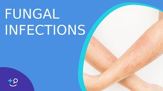 Fungal Infections  Causes Prevention and Cure [upl. by Imotas]