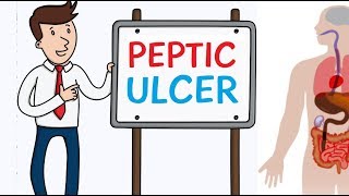 Microbiology  Helicobacter Pylori Ulcer [upl. by Sillihp]