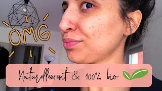 COMMENT JAI SAUVÉ MA PEAU DE LACNE EN UNE NUIT  Ma nouvelle routine soin bio amp naturelle 🌿 [upl. by Rehposirhc]