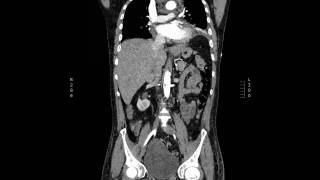 Thoracic Descending Aorta Anatomy amp Branches  Kenhub [upl. by Gaidano]