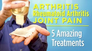 5 Amazing Treatments for Arthritis Rheumatoid Arthritis and Joint Pain That Work [upl. by Annohs]